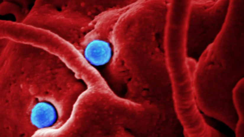 A Reference to the ICJ for an Advisory Opinion over COVID-19 Pandemic
